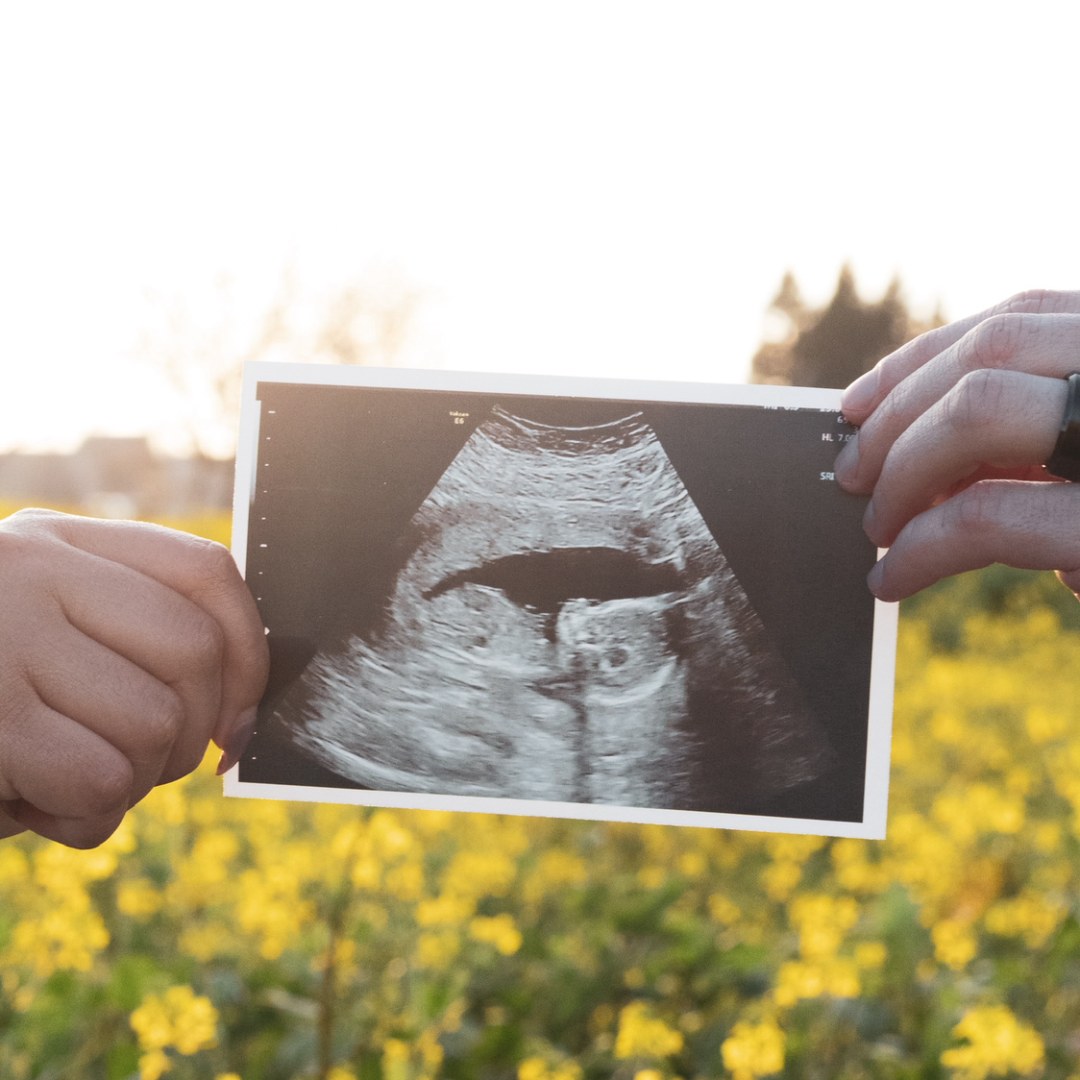 Photo shared by Jordan for their Babylist baby registry.