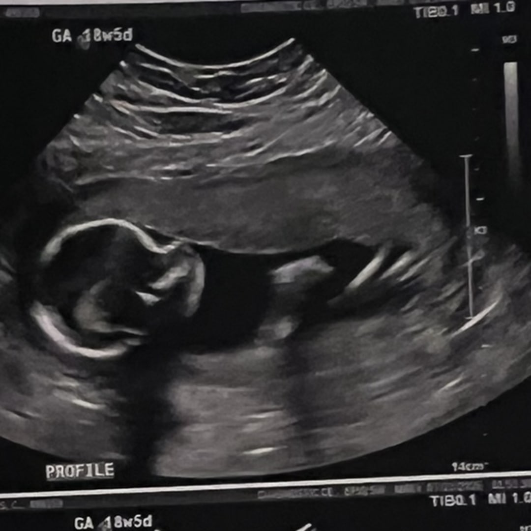 Photo shared by Claudia for their Babylist baby registry.