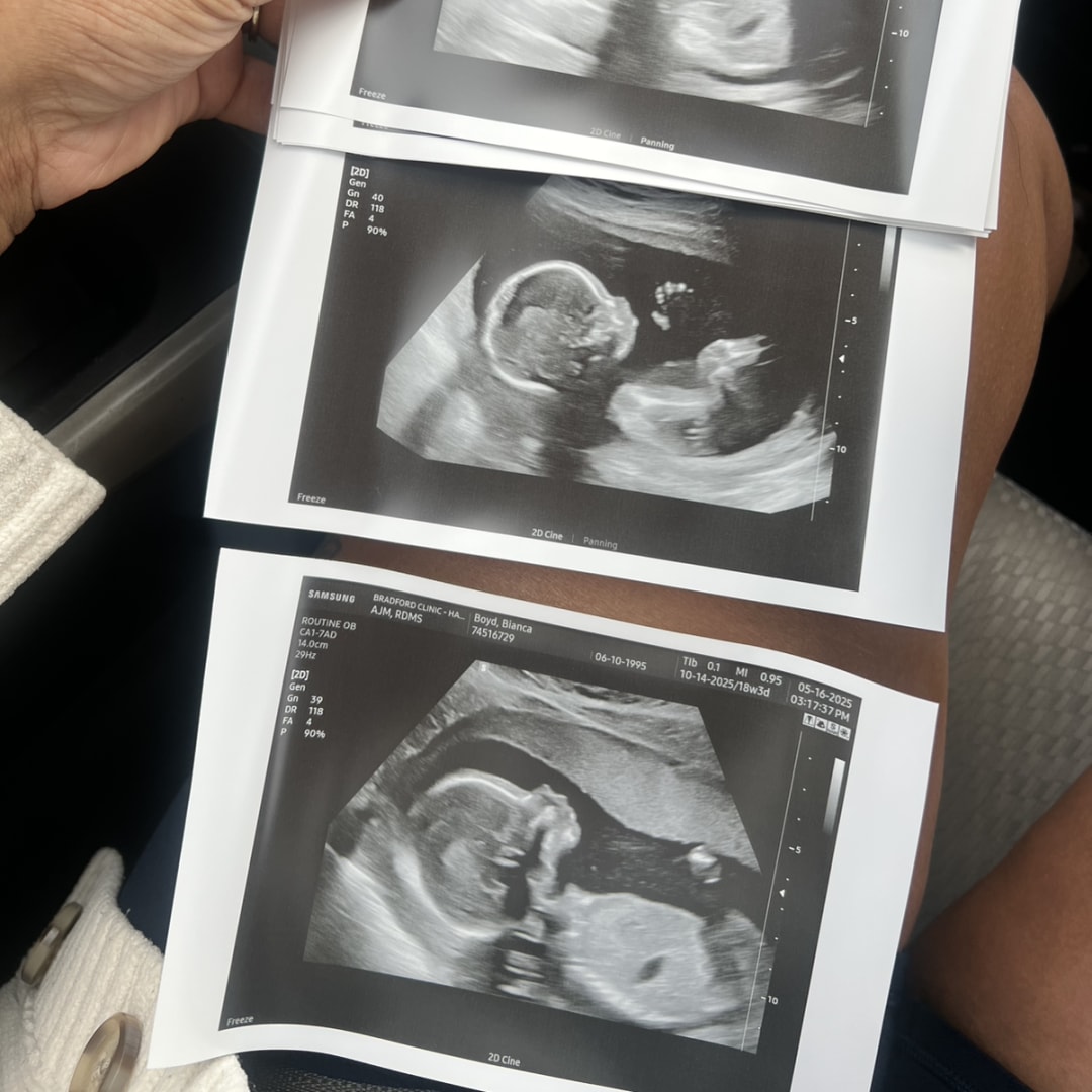 Photo shared by Bianca for their Babylist baby registry.