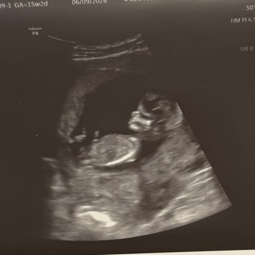 Photo shared by Jodi for their Babylist baby registry.
