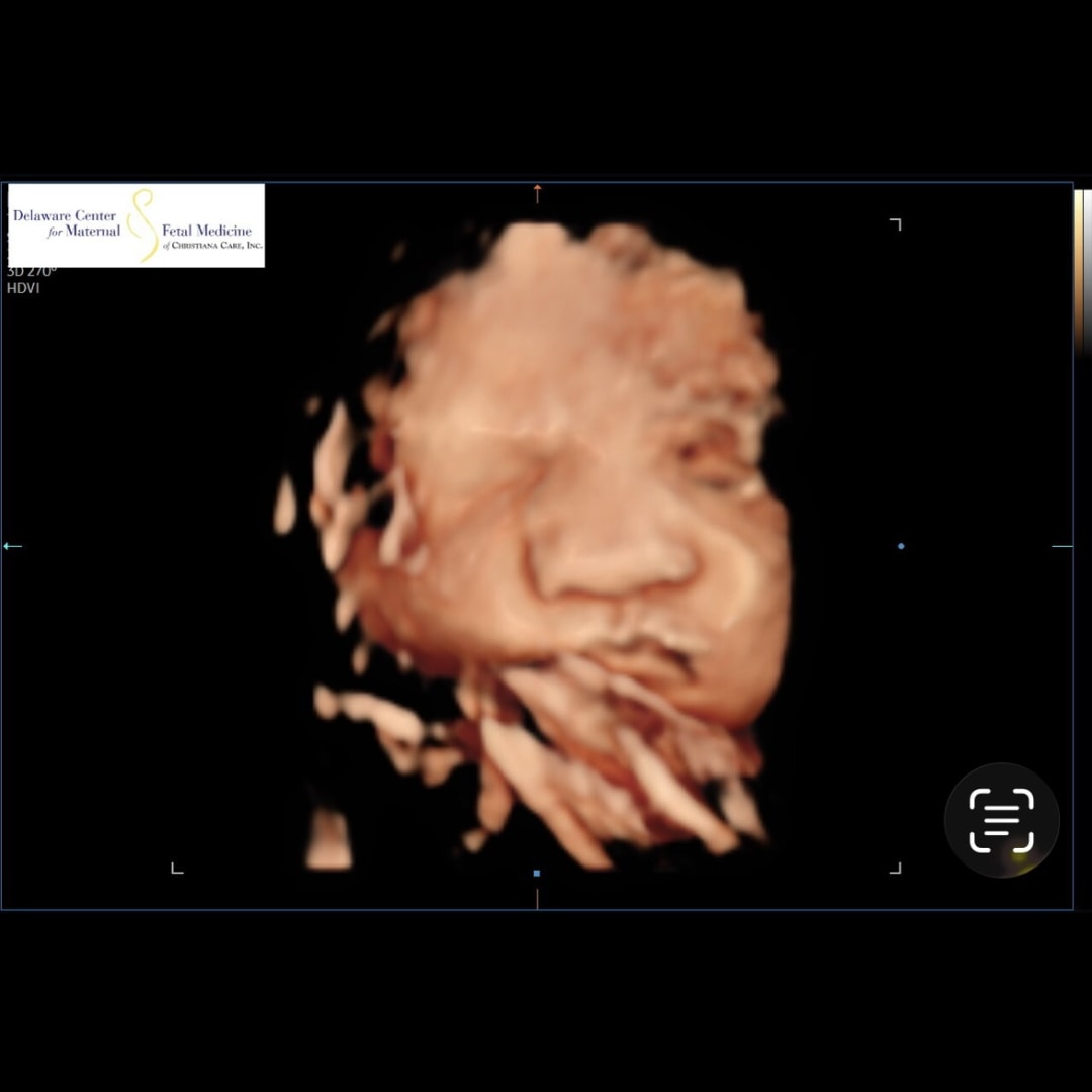 Photo shared by Zhea for their Babylist baby registry.