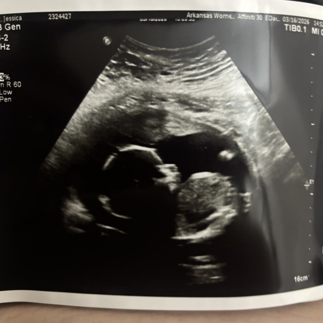 Photo shared by Jade for their Babylist baby registry.