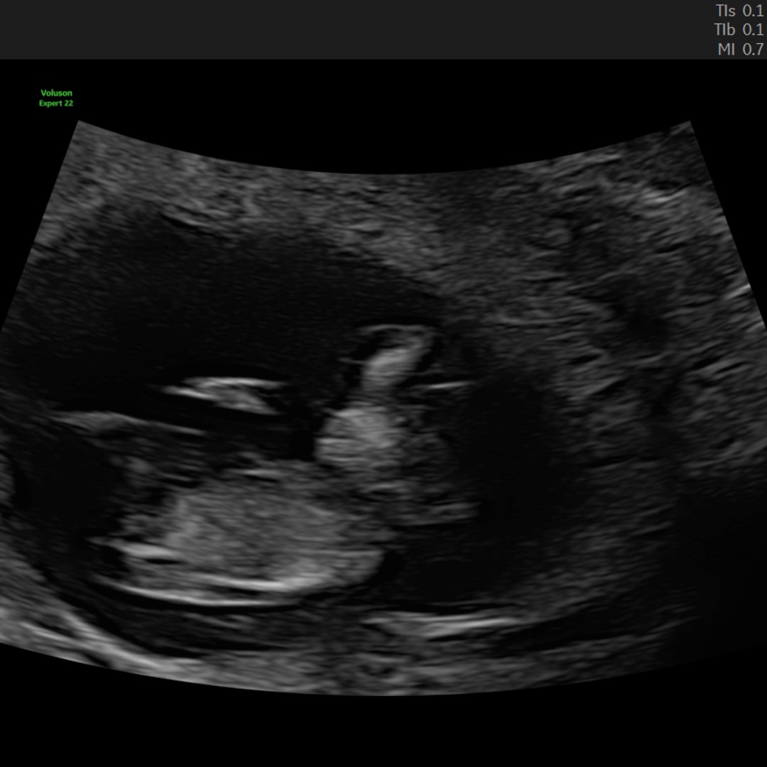 Photo shared by Ash for their Babylist baby registry.