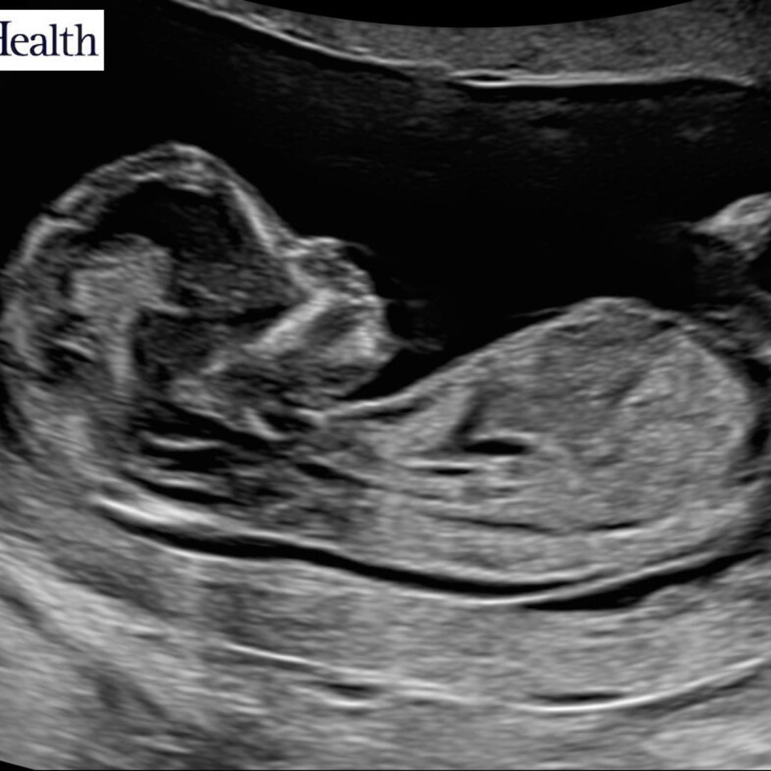 Photo shared by Bailey for their Babylist baby registry.