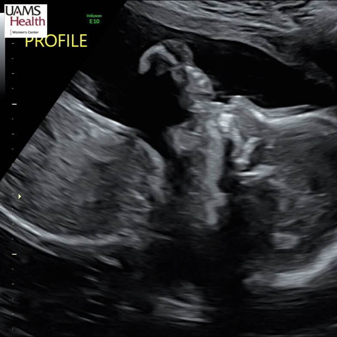 Photo shared by Ian for their Babylist baby registry.