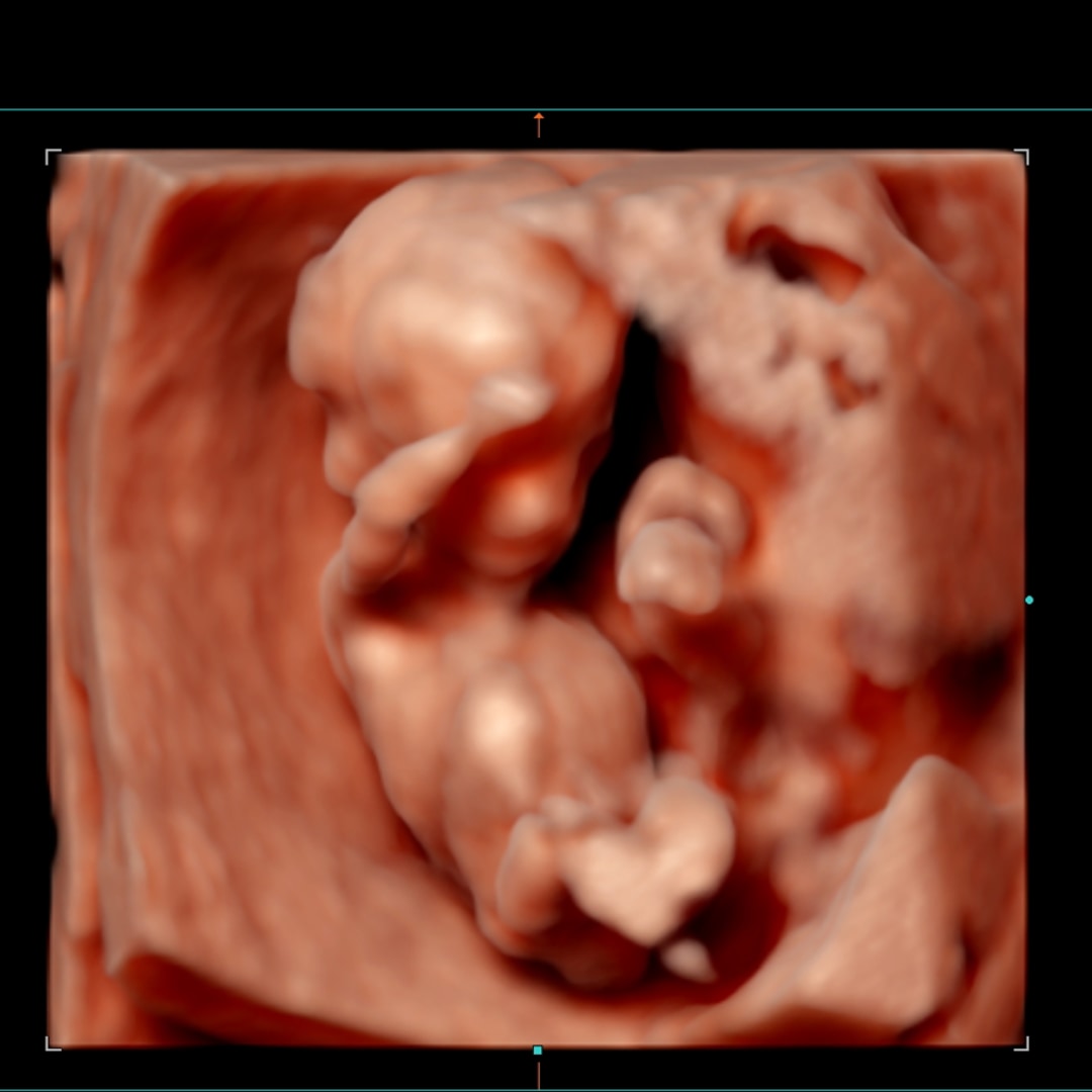 Photo shared by Reagan for their Babylist baby registry.
