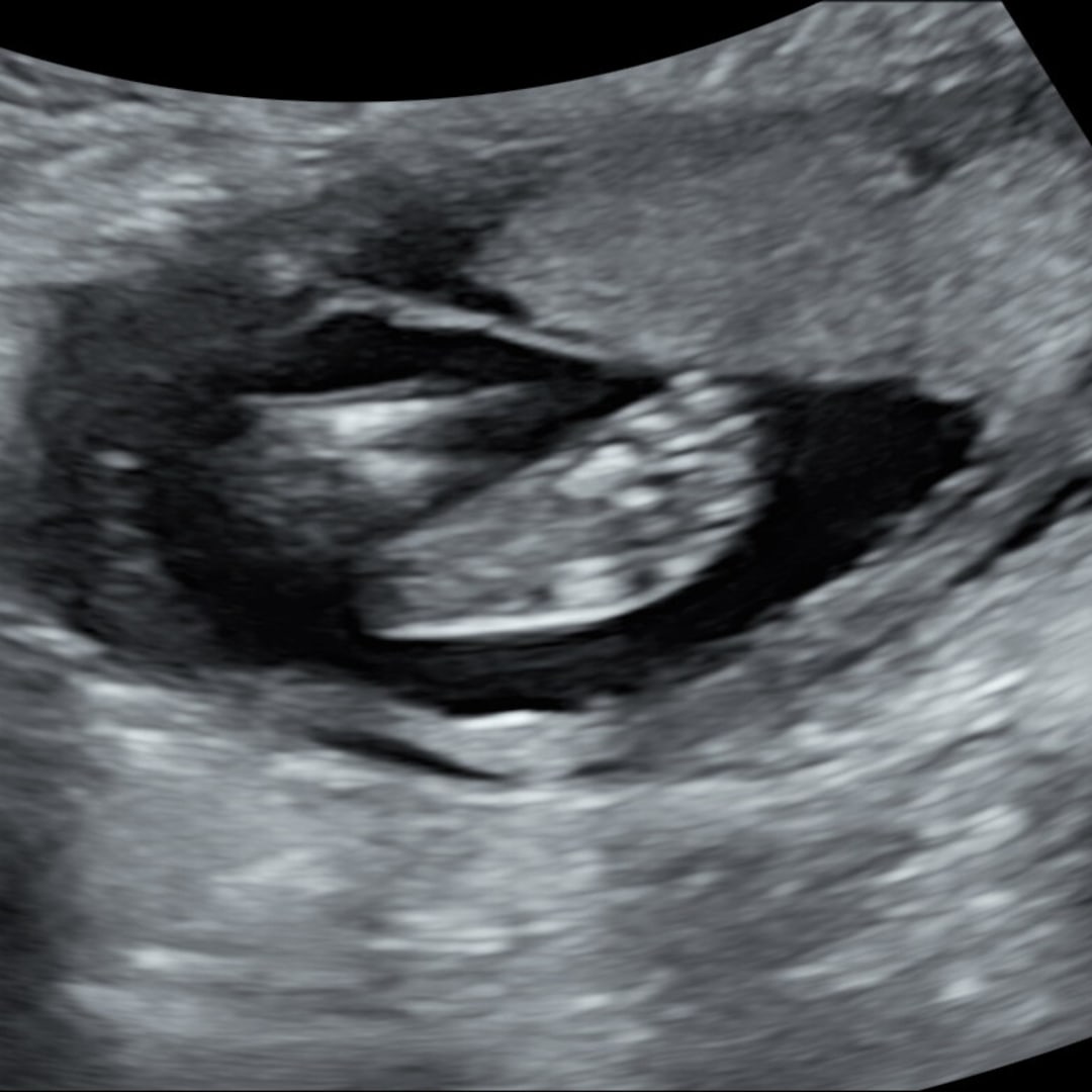 Photo shared by Amanda for their Babylist baby registry.