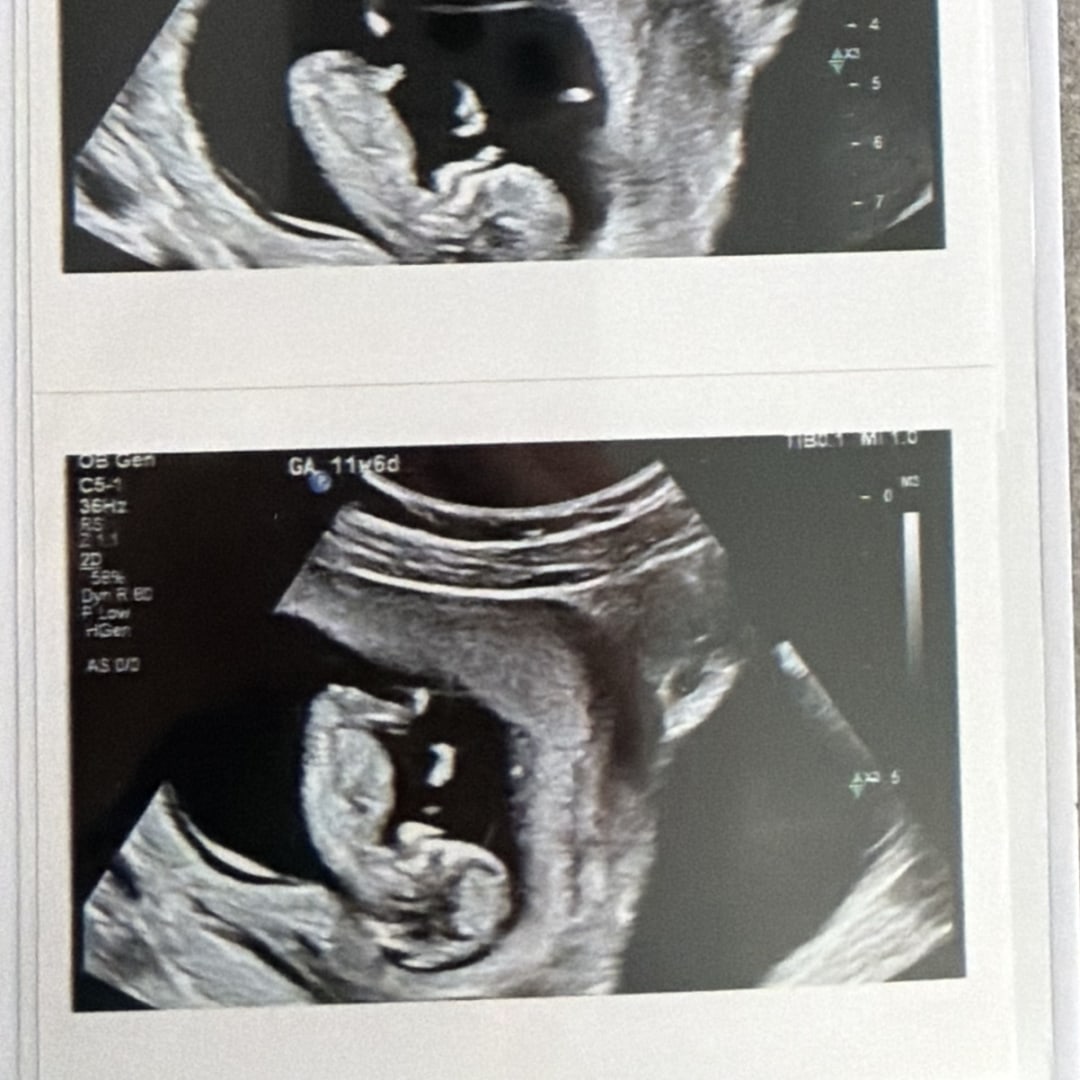 Photo shared by Hannah for their Babylist baby registry.