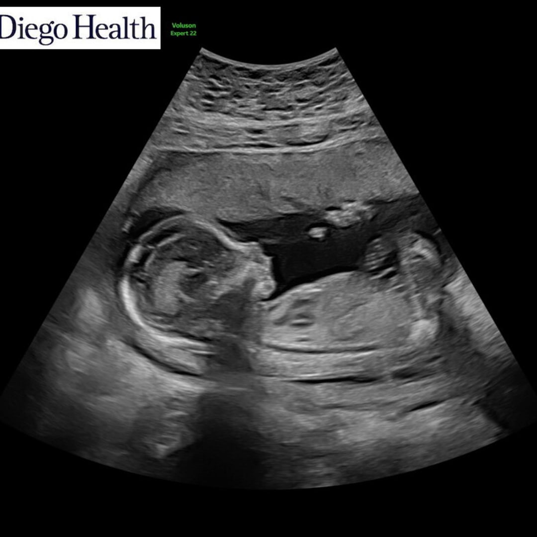 Photo shared by Casey for their Babylist baby registry.