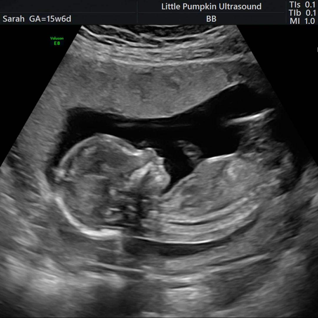 Photo shared by Sarah for their Babylist baby registry.