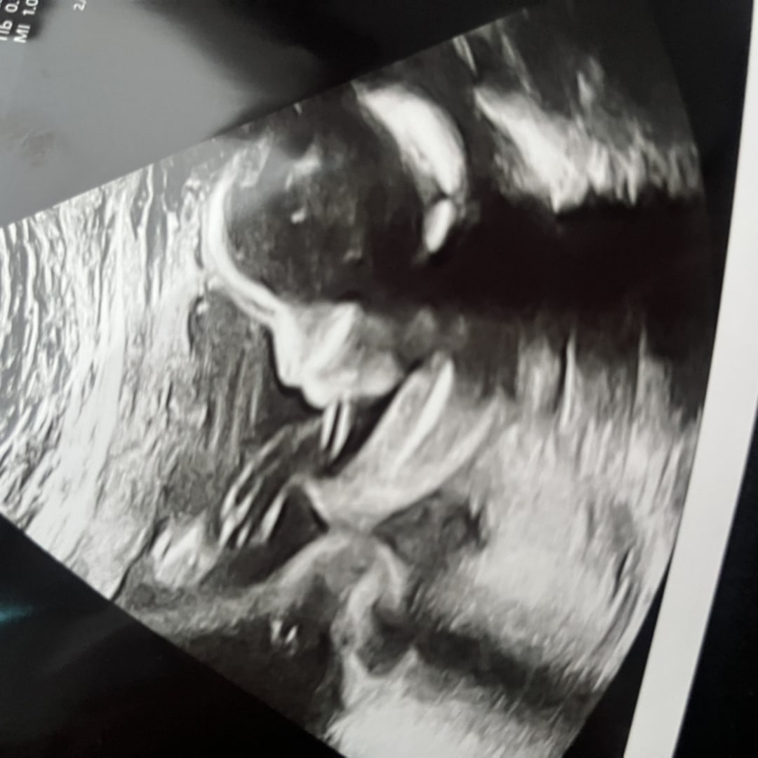 Photo shared by Yamila for their Babylist baby registry.