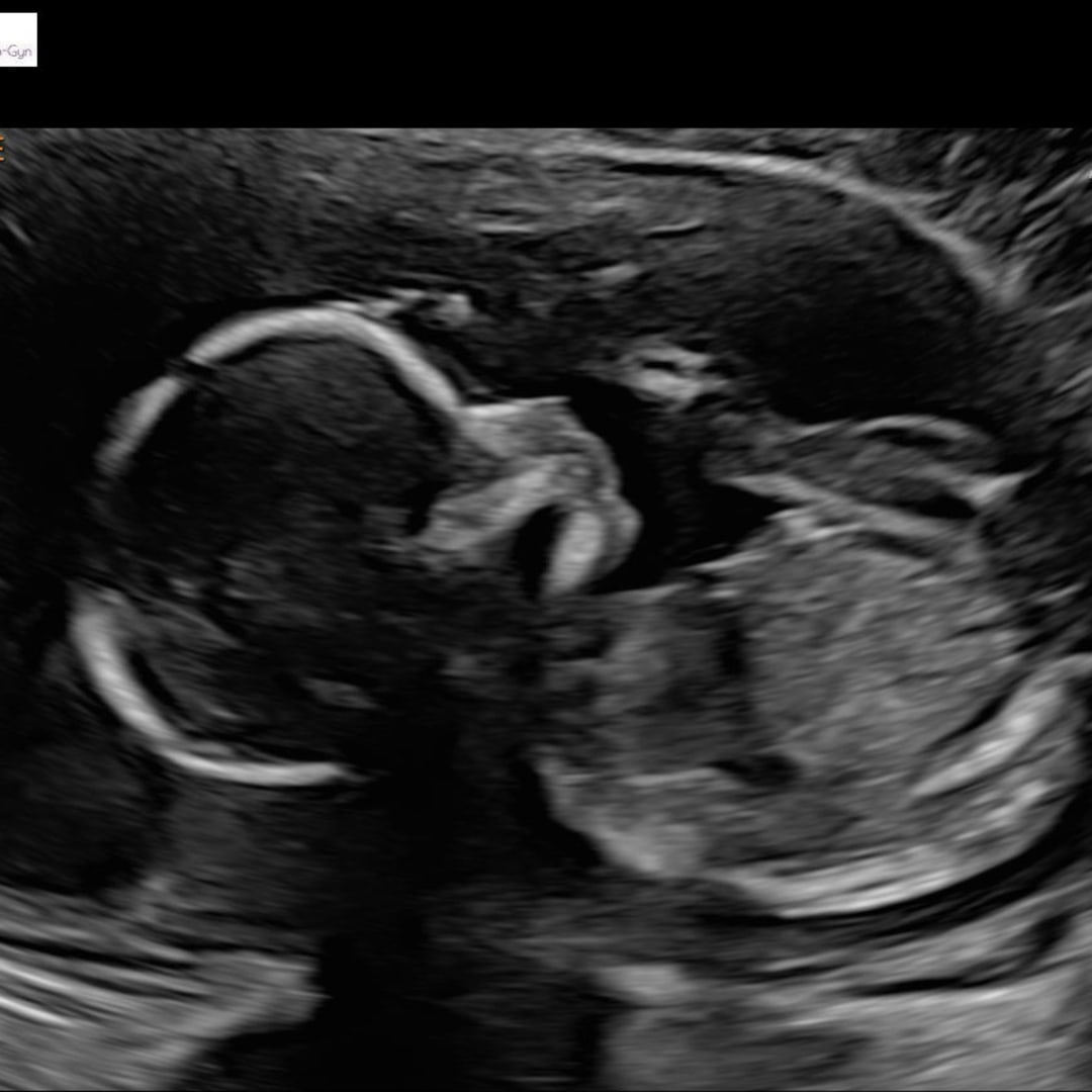 Photo shared by Mikayla for their Babylist baby registry.