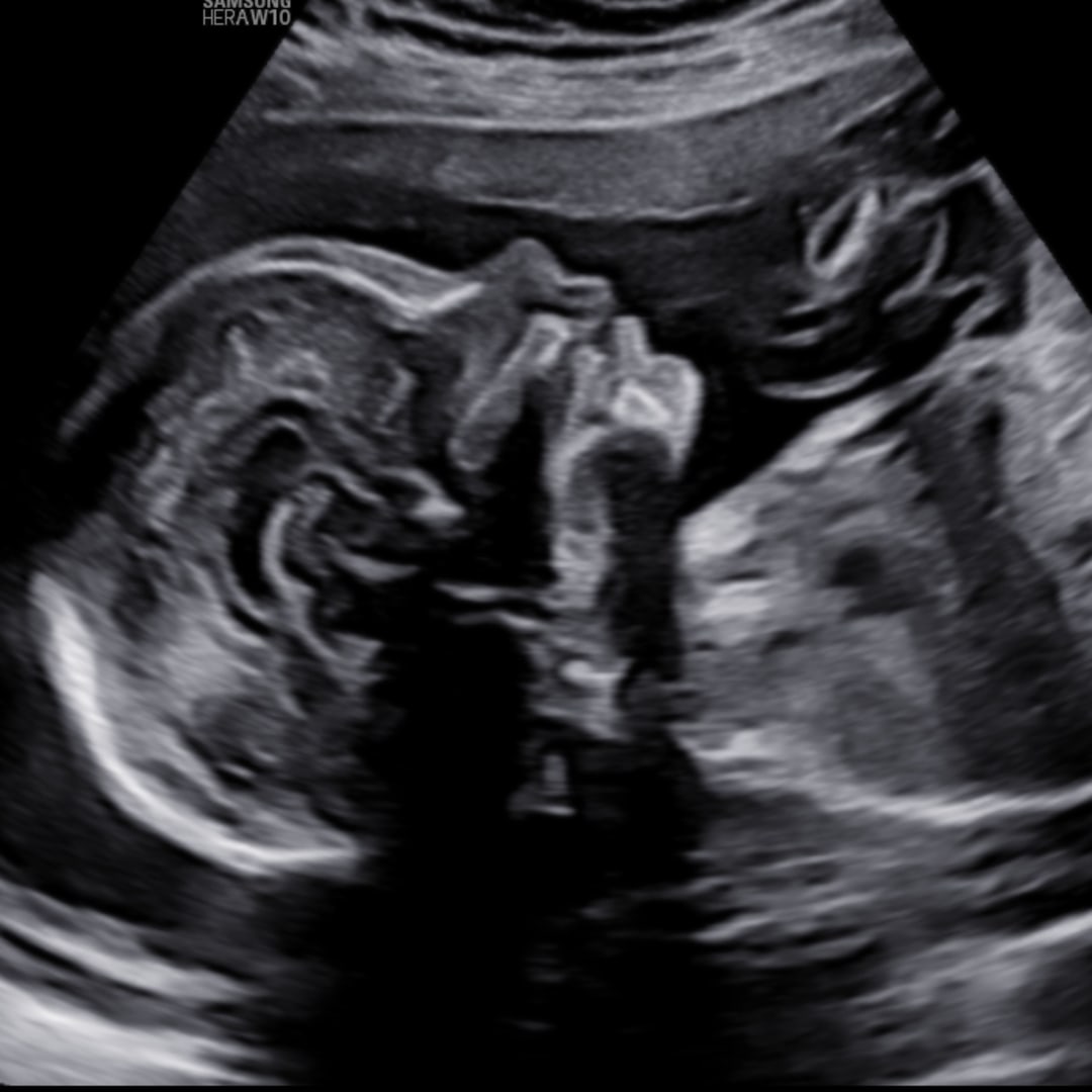 Photo shared by Campbell for their Babylist baby registry.