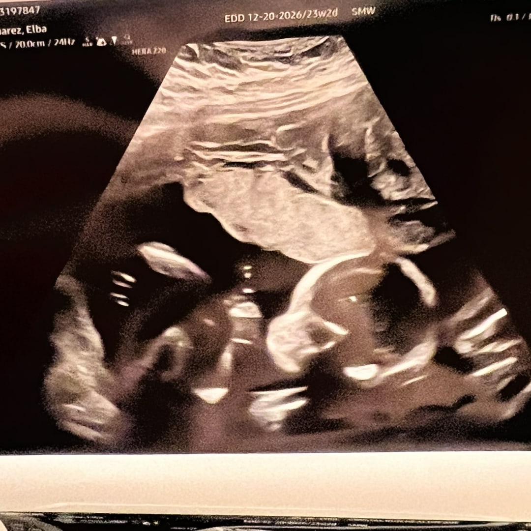 Photo shared by Elba for their Babylist baby registry.