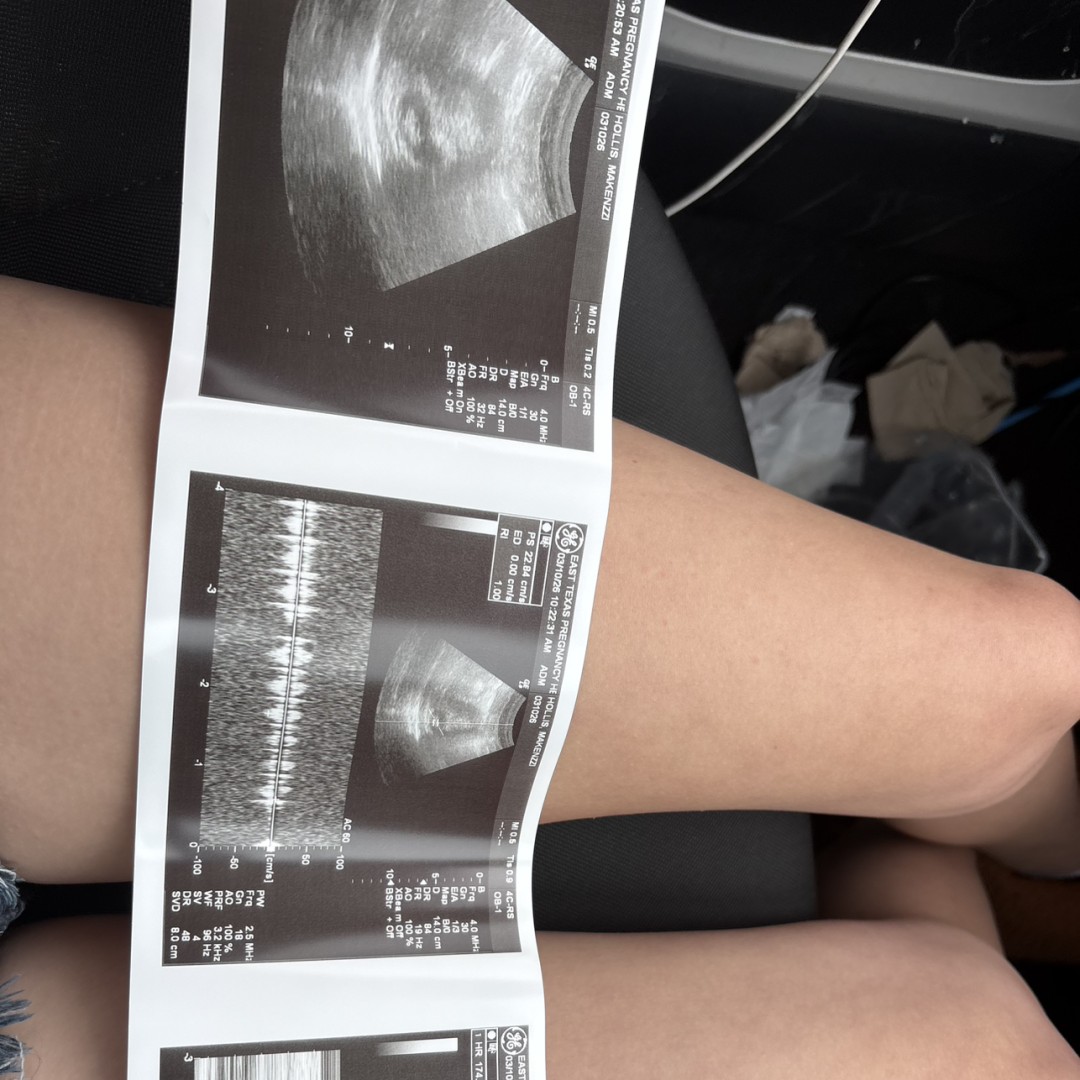Photo shared by Makenzzi for their Babylist baby registry.
