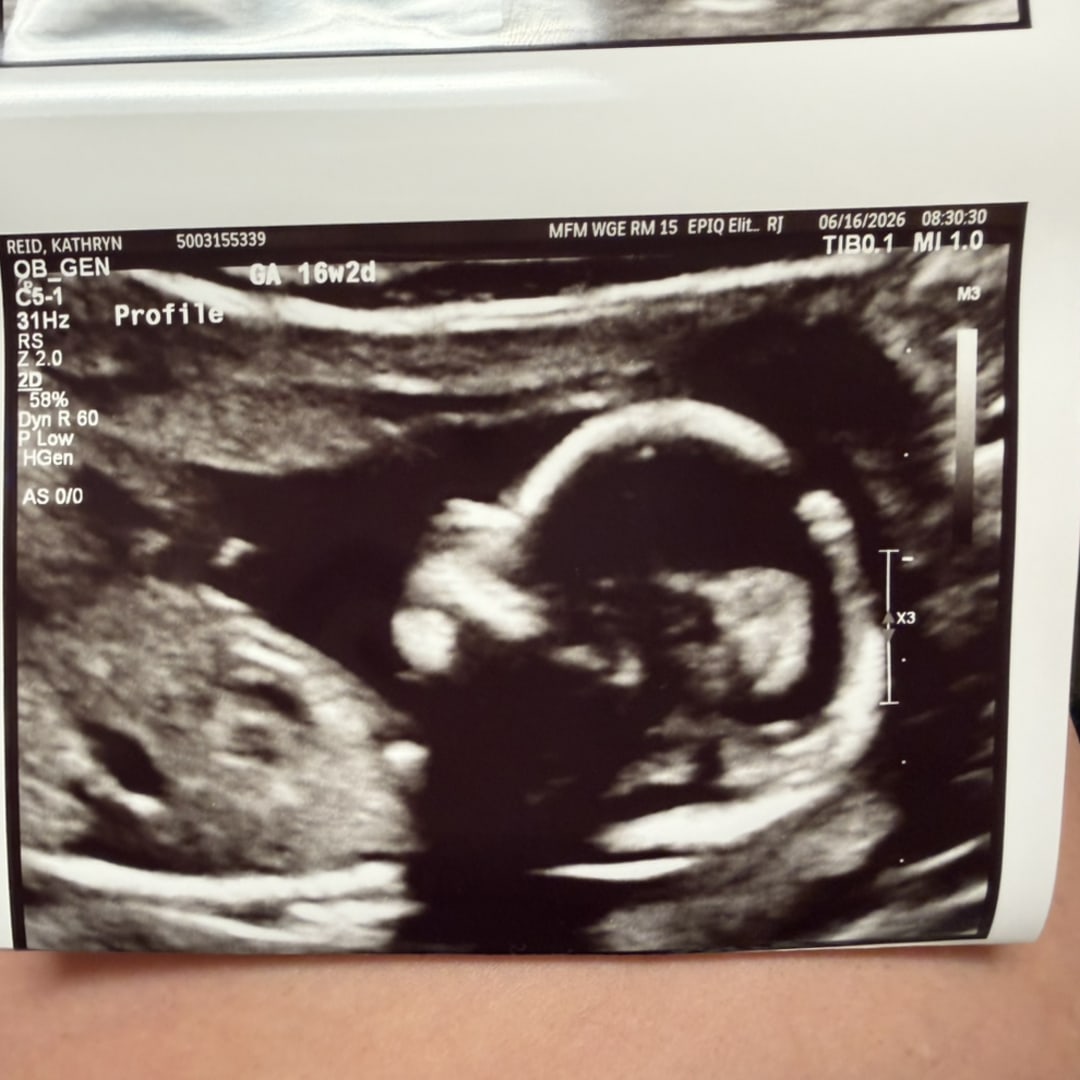 Photo shared by Katie for their Babylist baby registry.