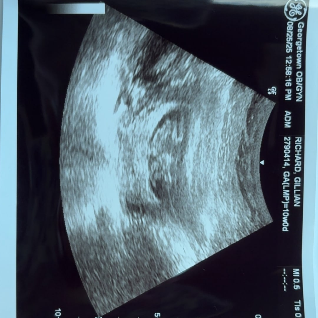 Photo shared by Gillian for their Babylist baby registry.
