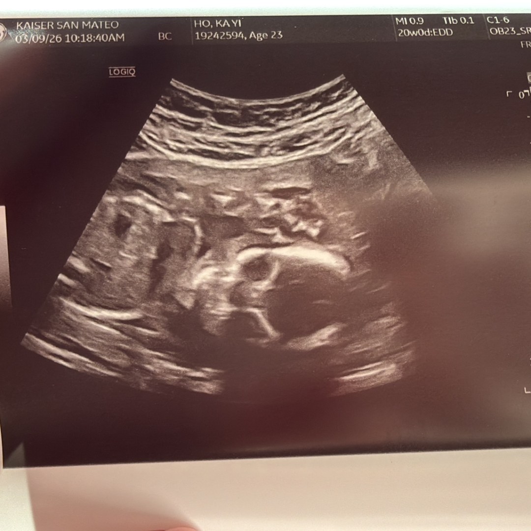Photo shared by Amelia for their Babylist baby registry.
