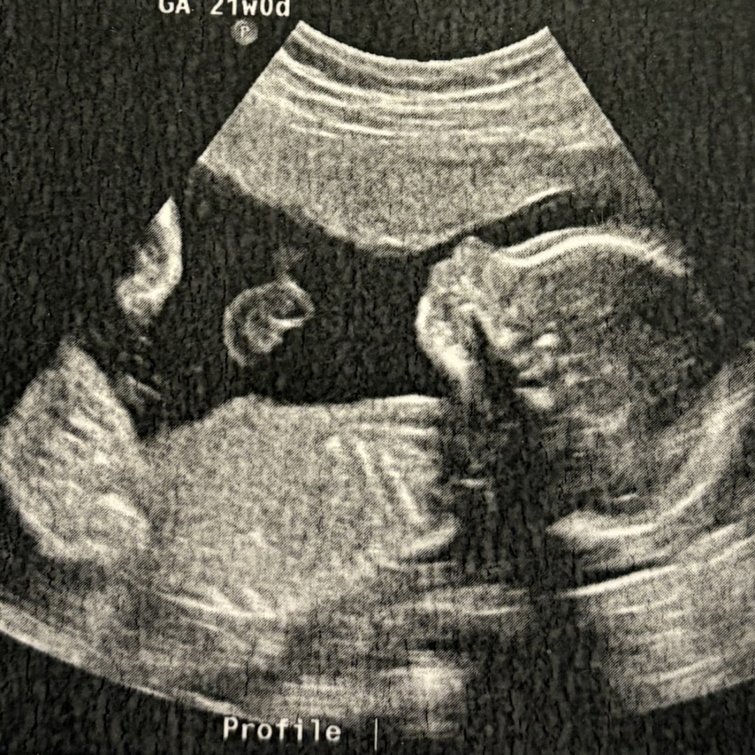 Photo shared by Fantasy for their Babylist baby registry.