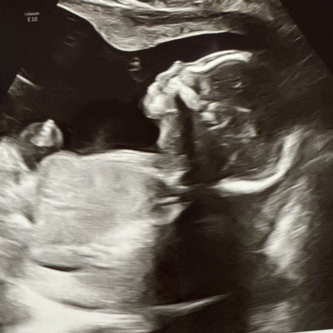 Photo shared by Kathryne for their Babylist baby registry.