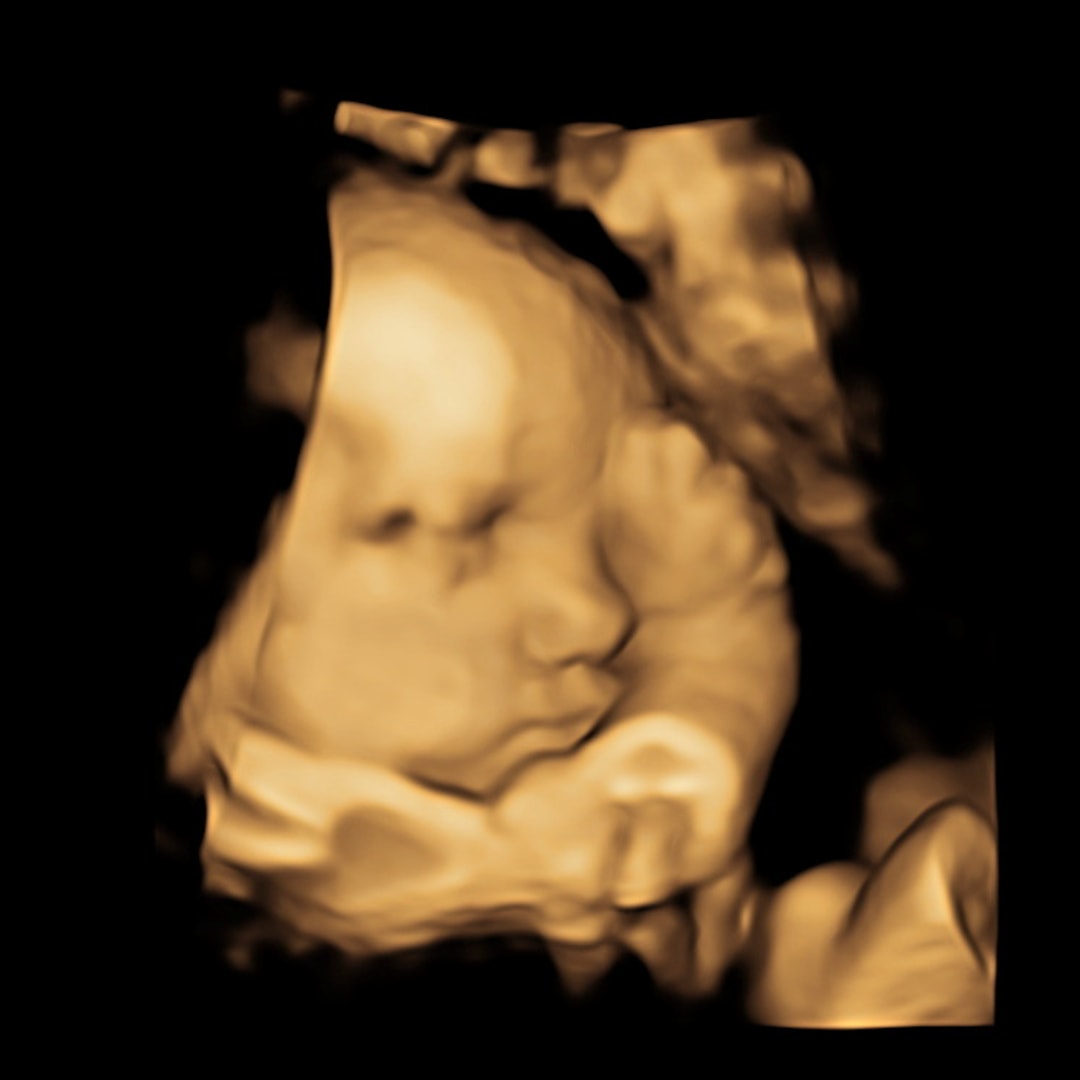Photo shared by Madison for their Babylist baby registry.