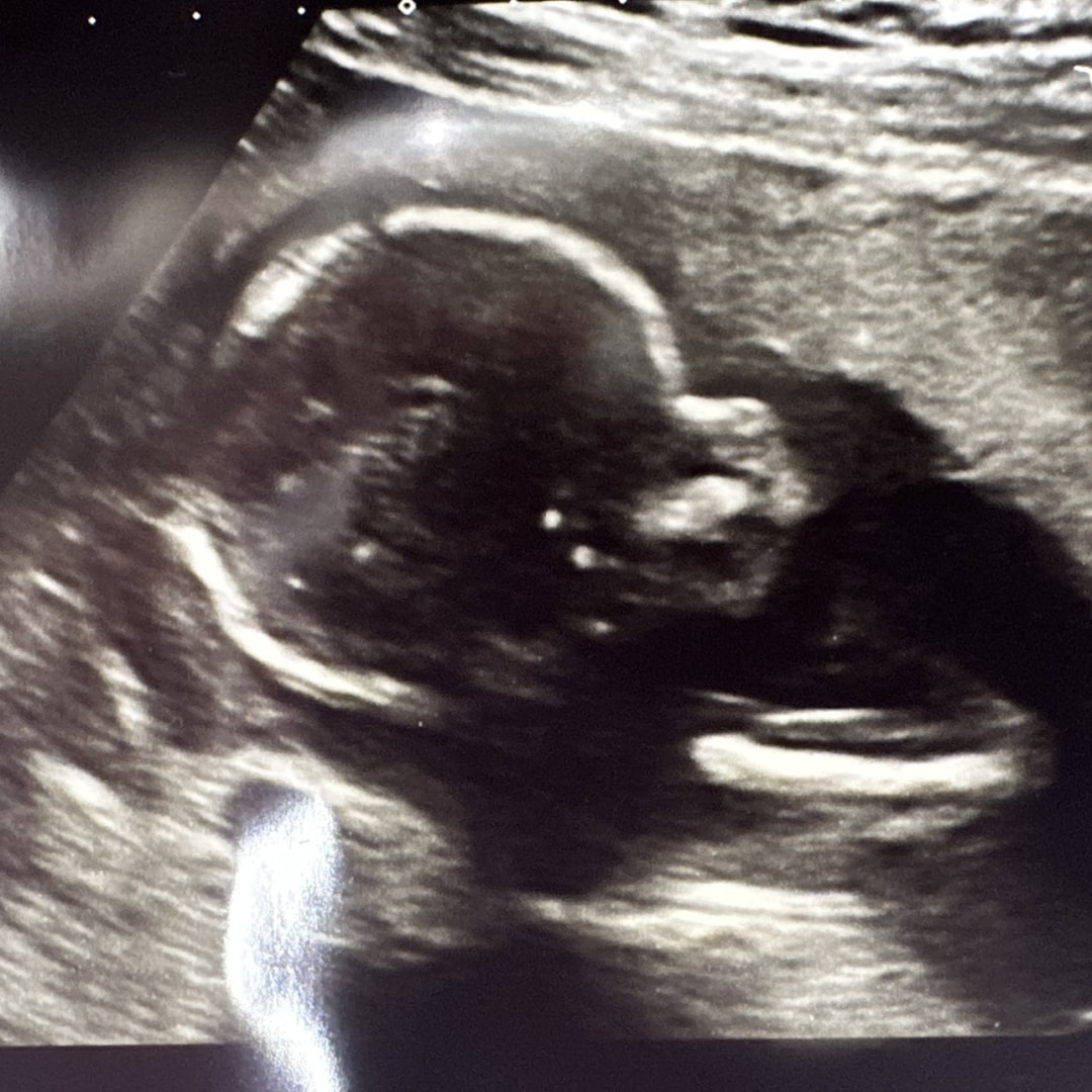 Photo shared by Jillian for their Babylist baby registry.