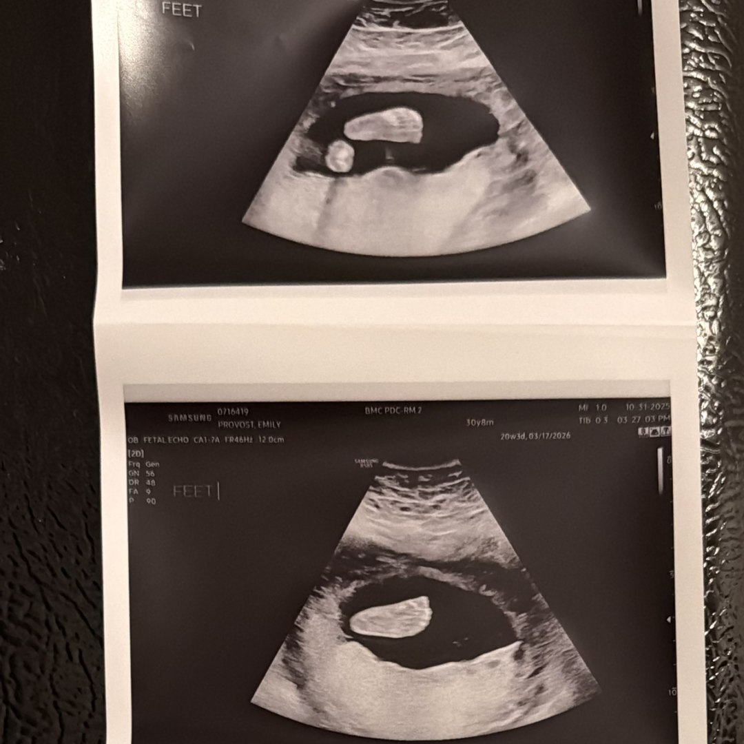 Photo shared by Emily for their Babylist baby registry.