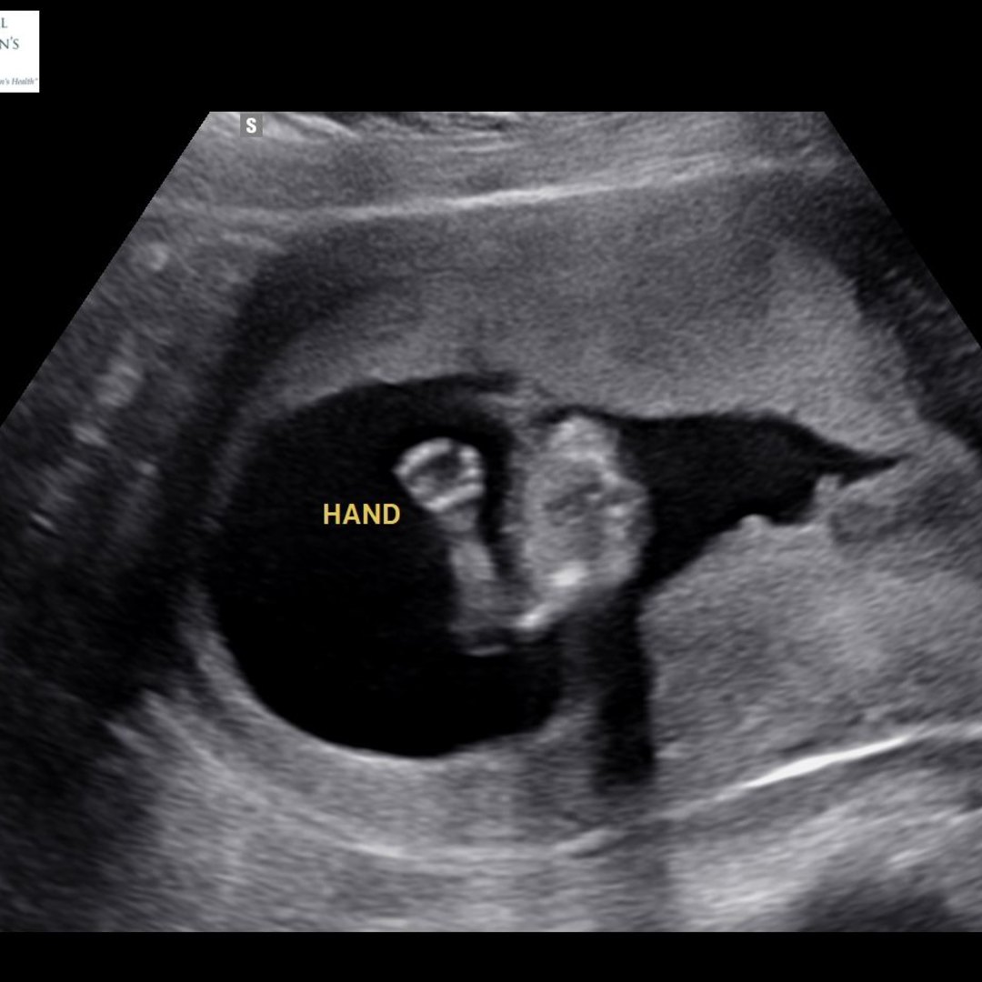 Photo shared by Amy for their Babylist baby registry.