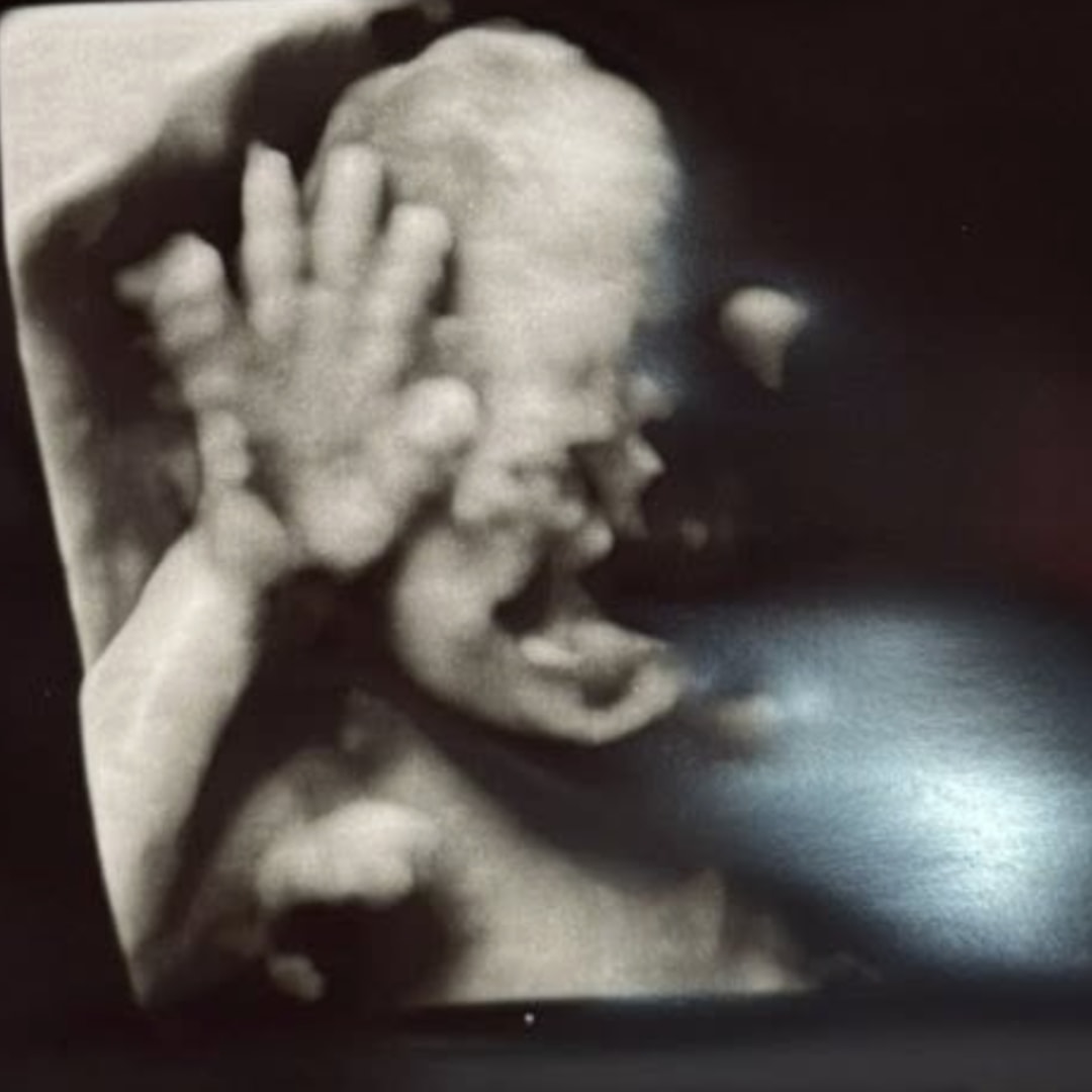 Photo shared by Emma for their Babylist baby registry.