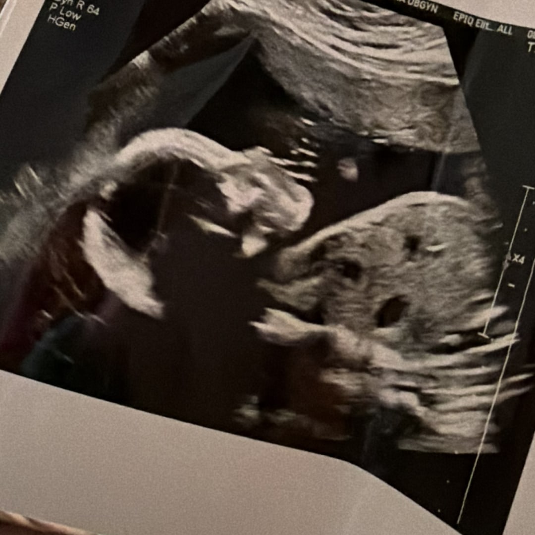 Photo shared by Jessie for their Babylist baby registry.