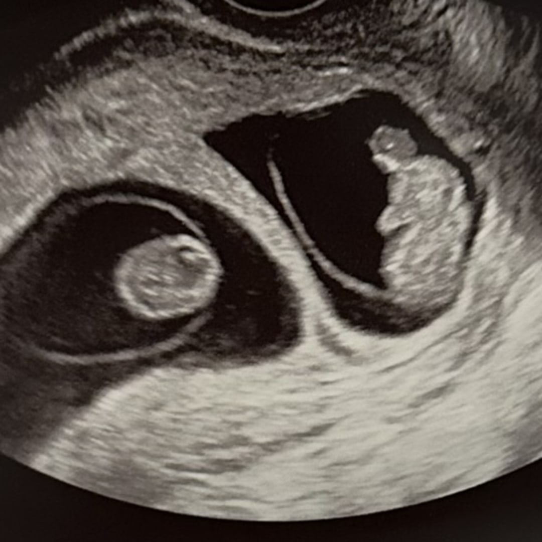 Photo shared by Sarah for their Babylist baby registry.