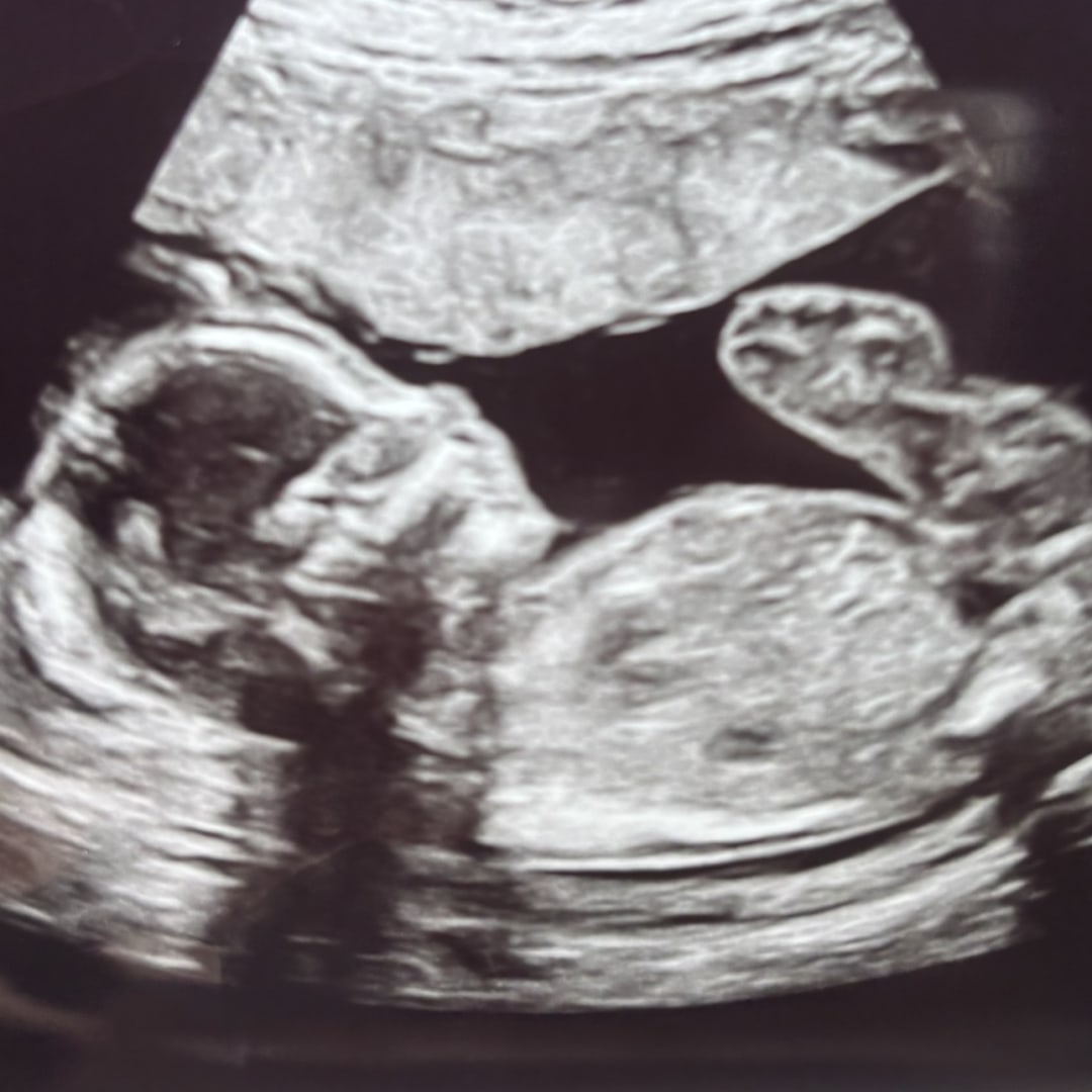 Photo shared by Jasmine for their Babylist baby registry.