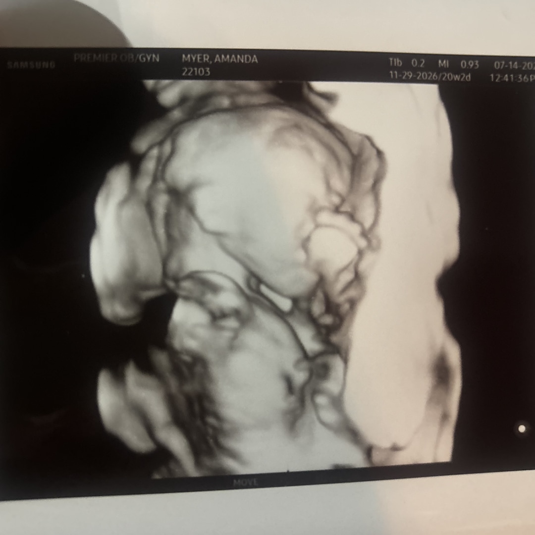 Photo shared by Mandy for their Babylist baby registry.