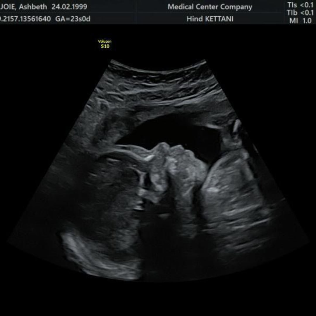 Photo shared by Ashbeth for their Babylist baby registry.