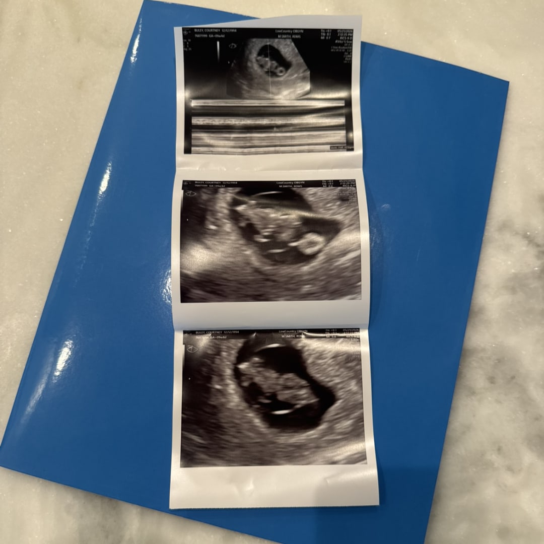 Photo shared by Chance for their Babylist baby registry.