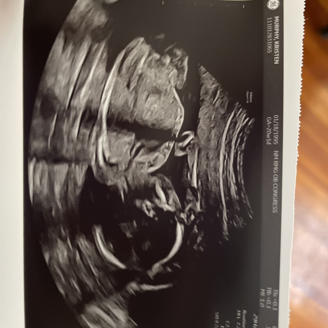Photo shared by Kristen for their Babylist baby registry.
