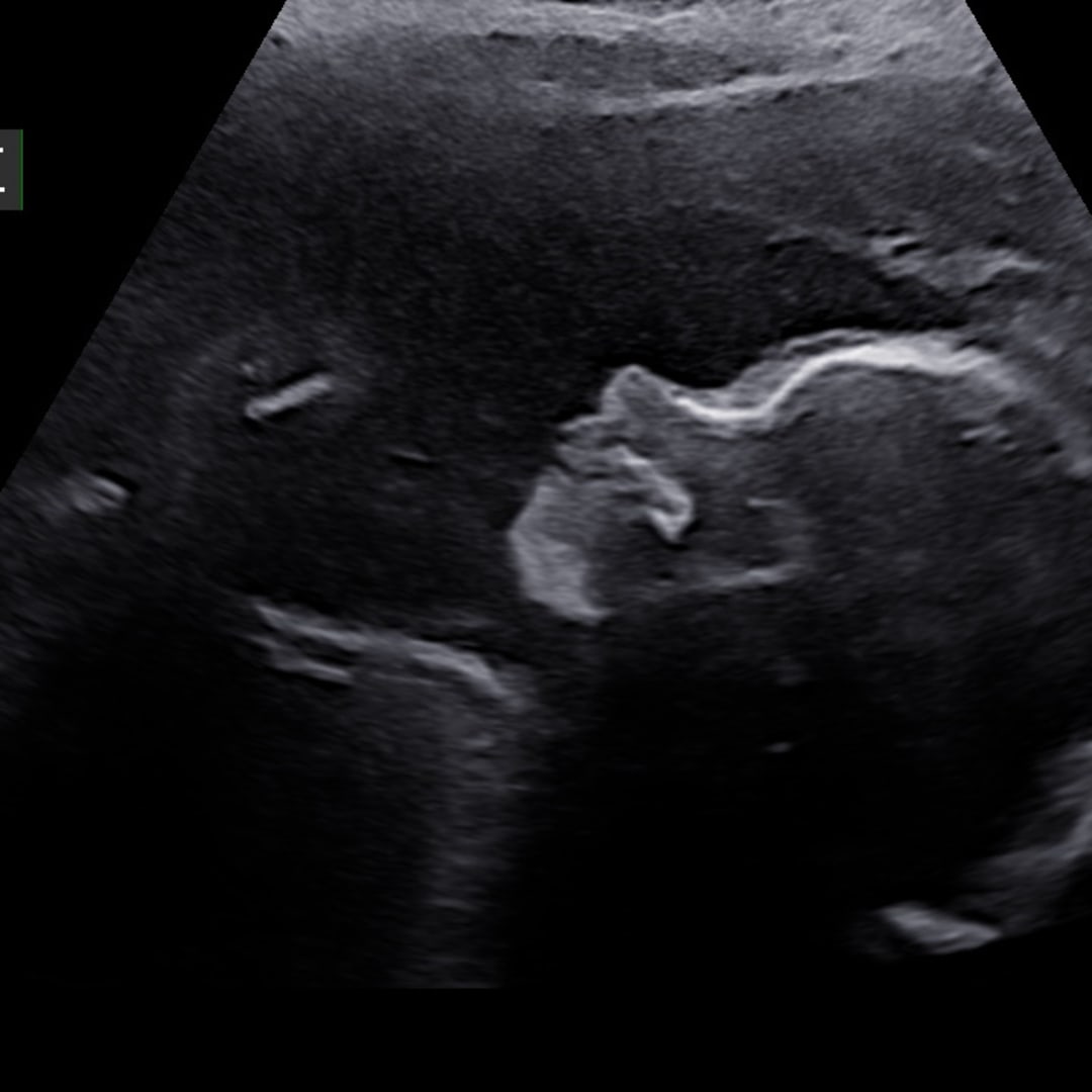 Photo shared by Alexis for their Babylist baby registry.