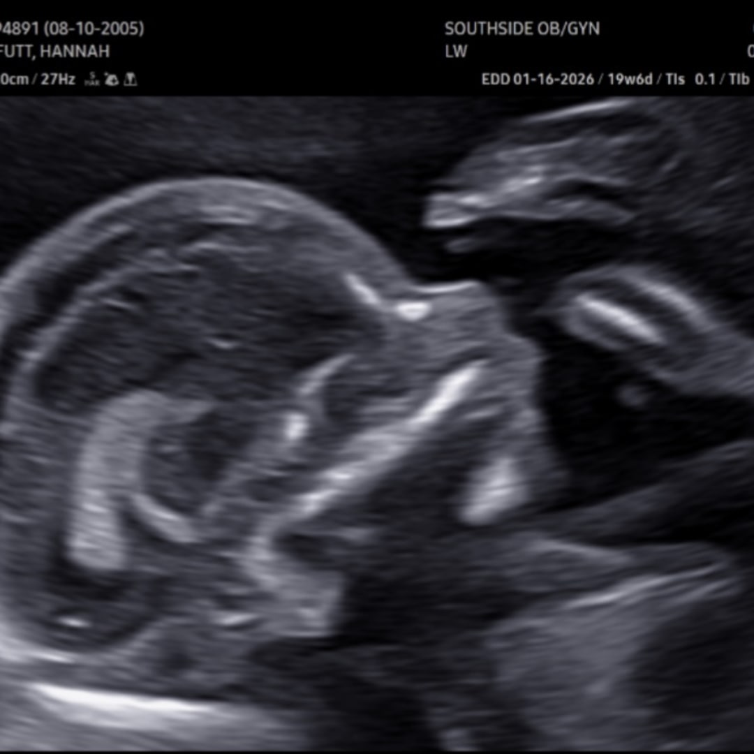 Photo shared by Hannah for their Babylist baby registry.