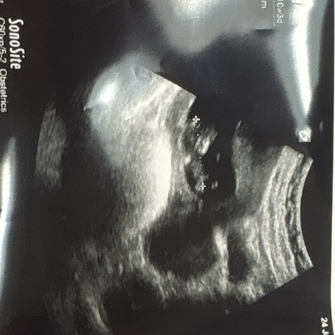 Photo shared by Hayley for their Babylist baby registry.