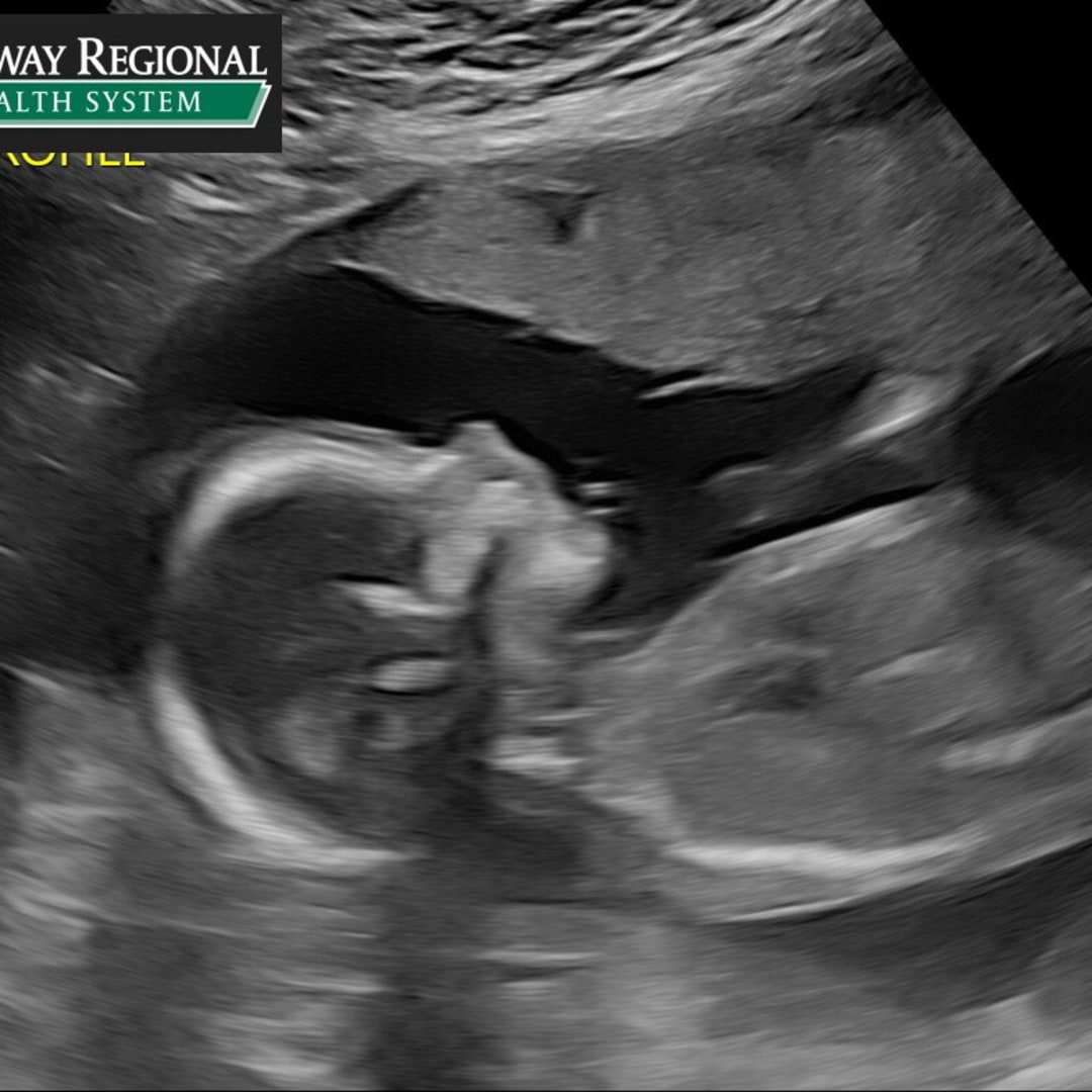 Photo shared by Rylie for their Babylist baby registry.
