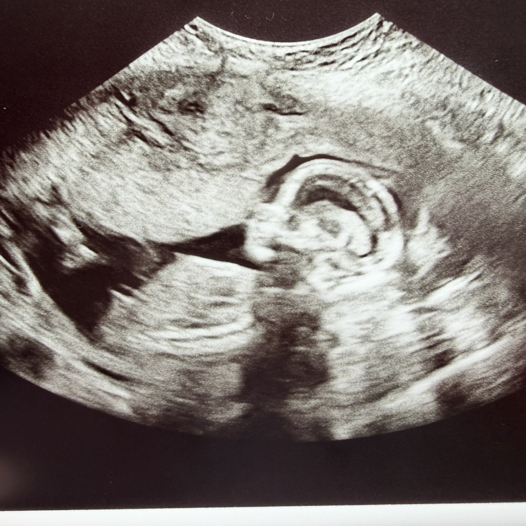 Photo shared by Jennifer for their Babylist baby registry.
