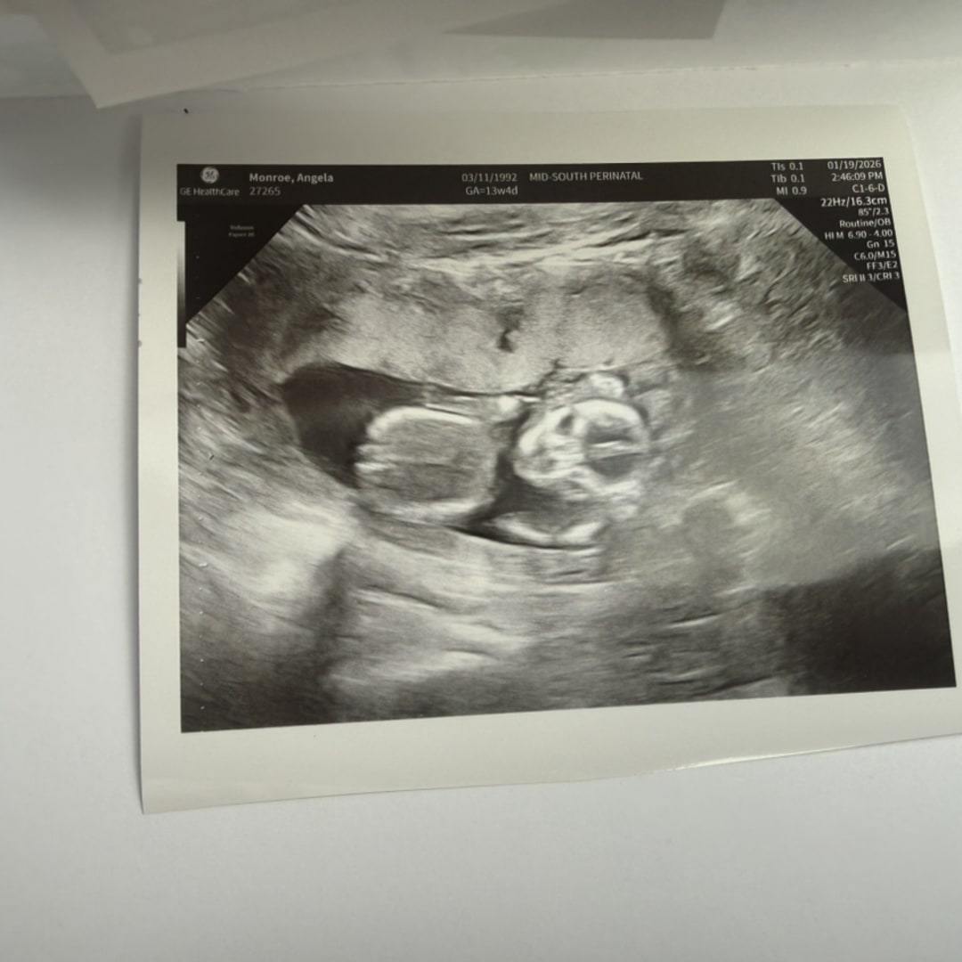 Photo shared by Angela for their Babylist baby registry.