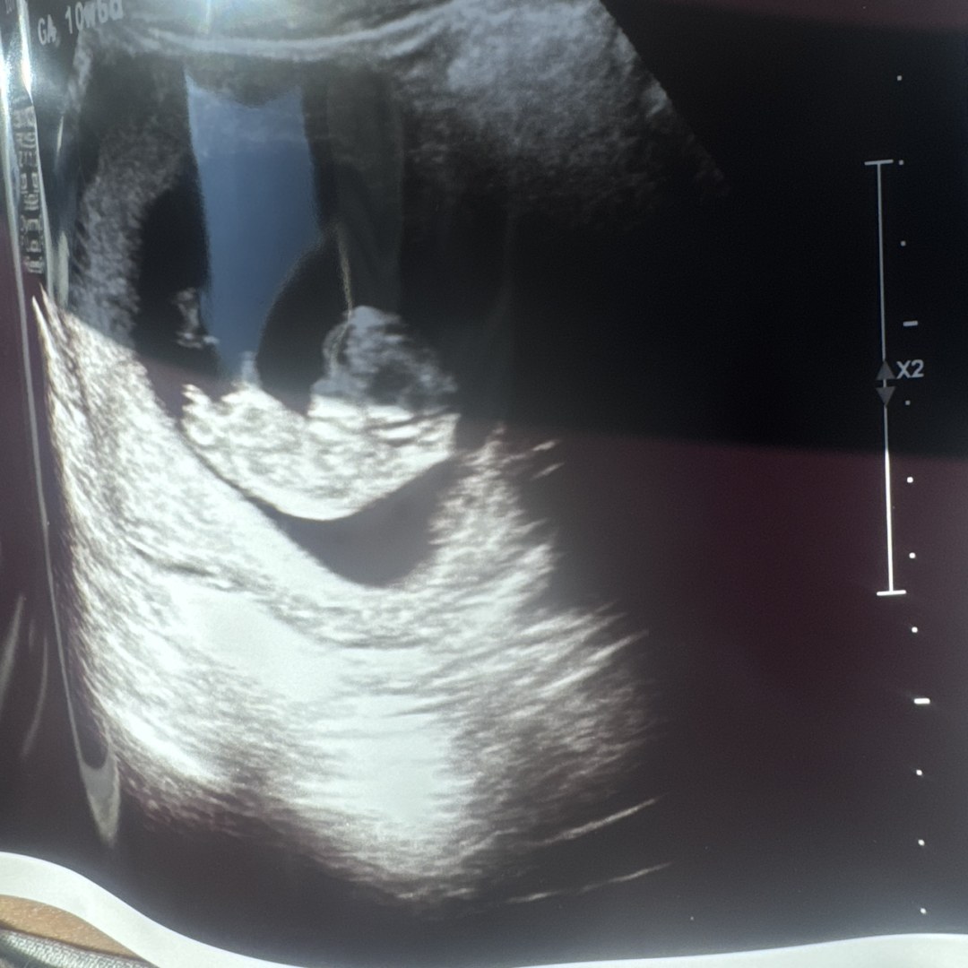 Photo shared by Alyson for their Babylist baby registry.