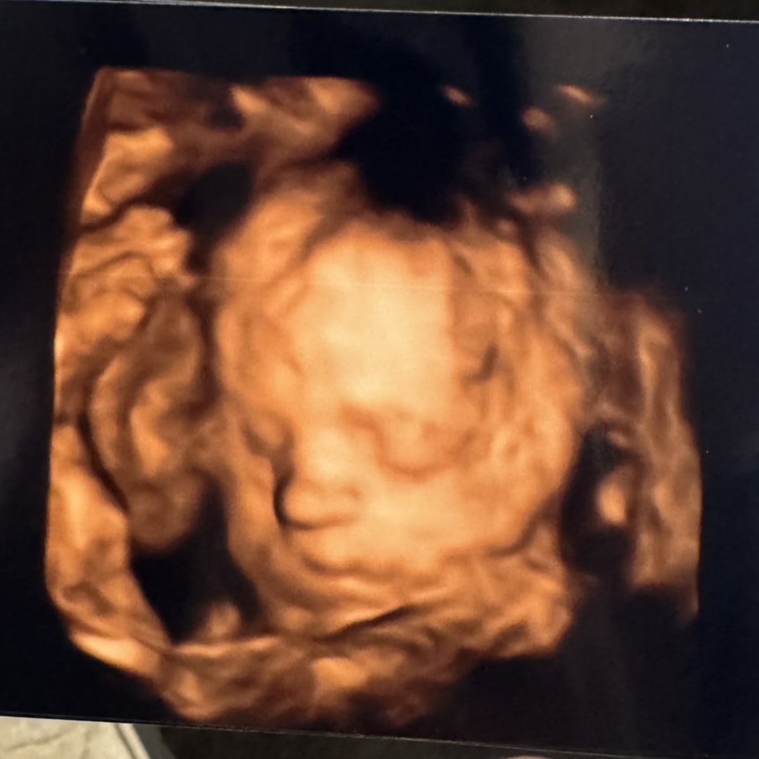 Photo shared by Caroline for their Babylist baby registry.