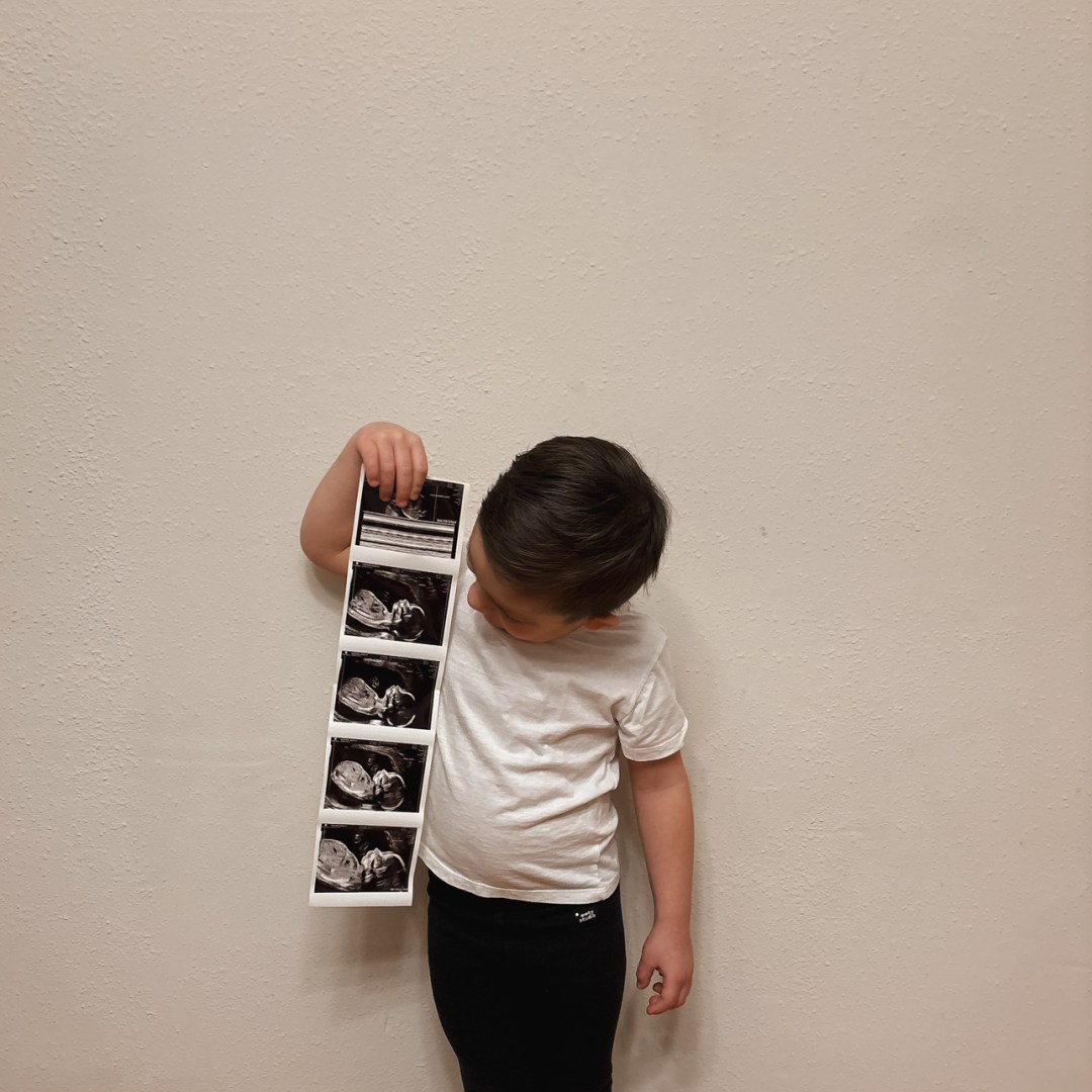 Photo shared by Angela for their Babylist baby registry.