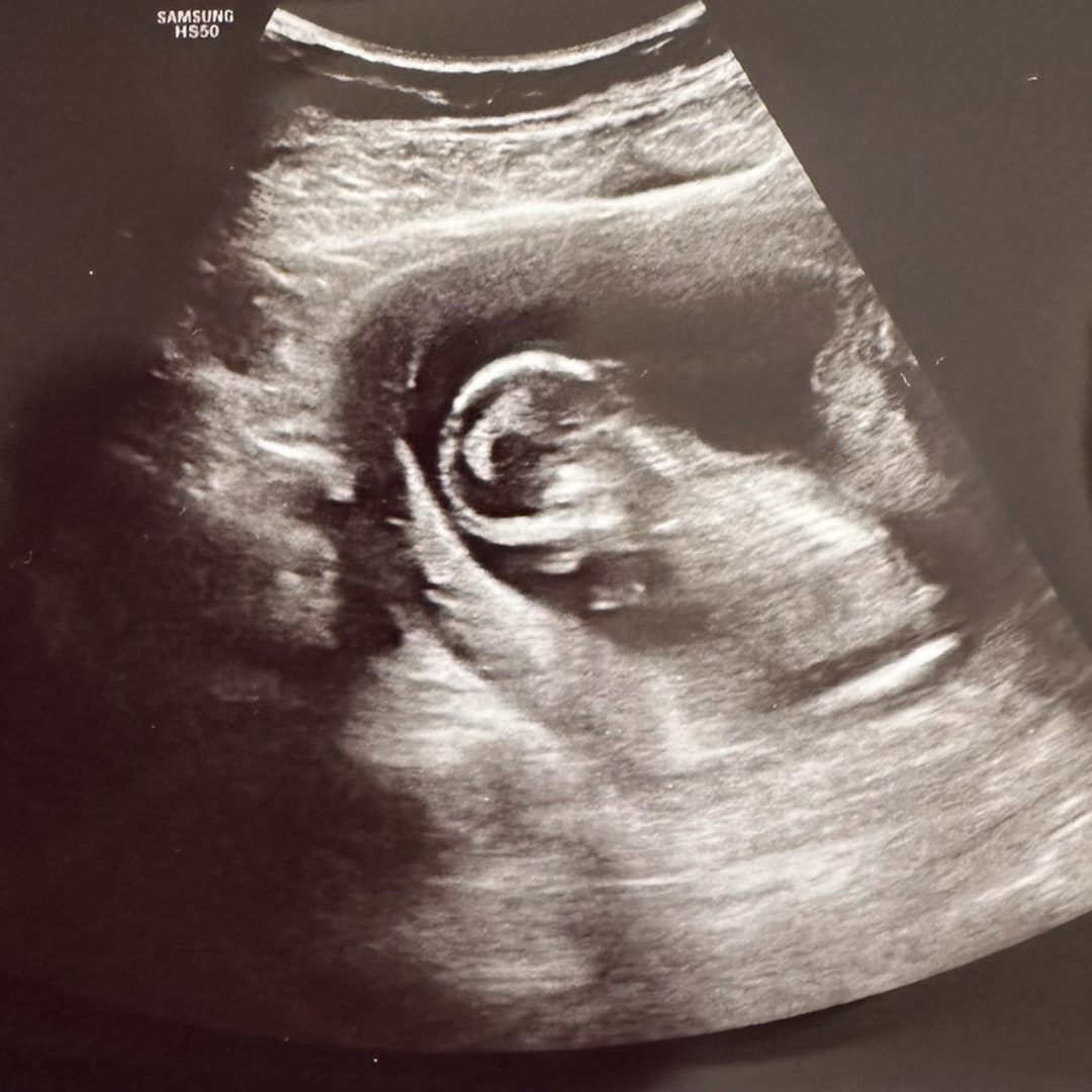 Photo shared by Maile for their Babylist baby registry.