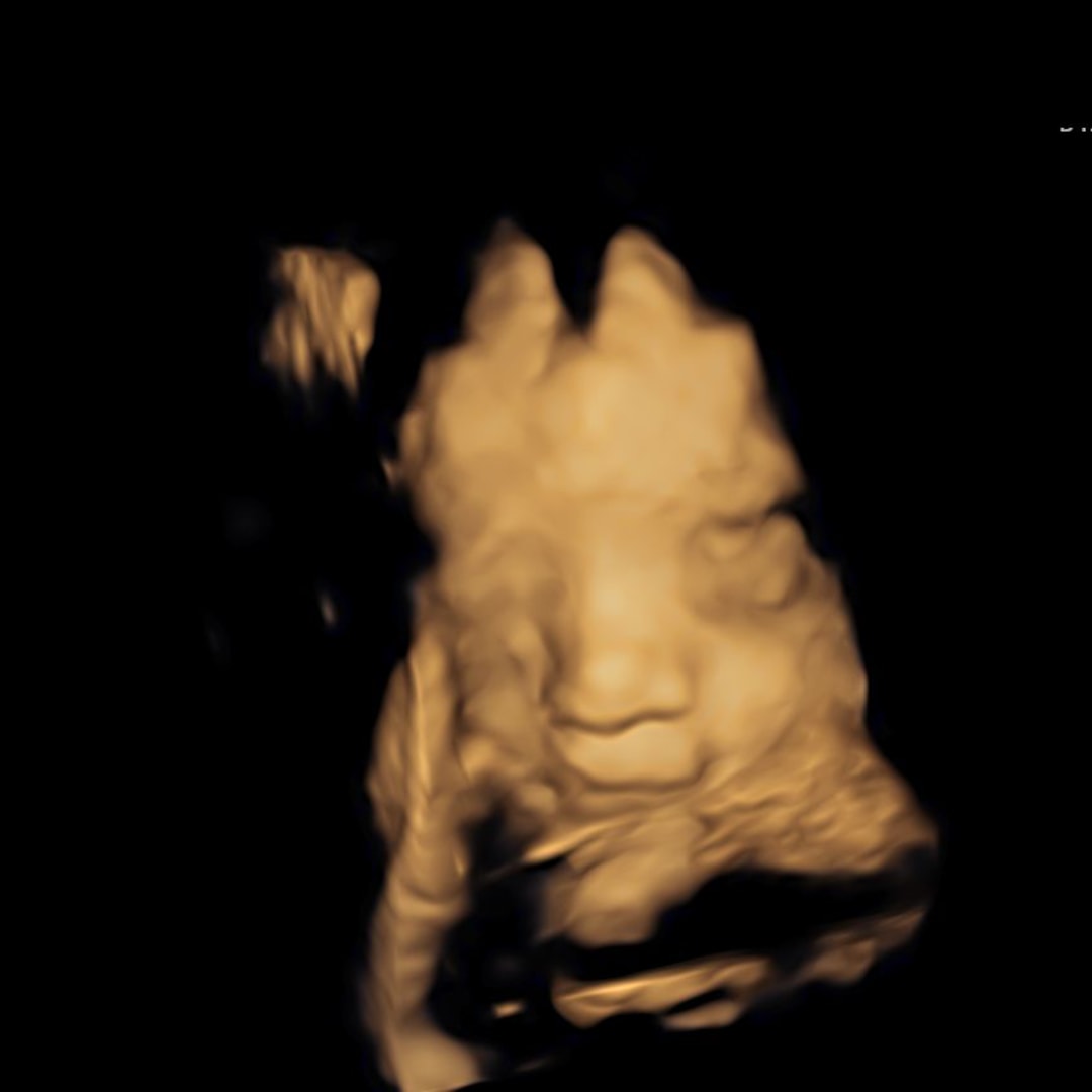 Photo shared by Kristen for their Babylist baby registry.