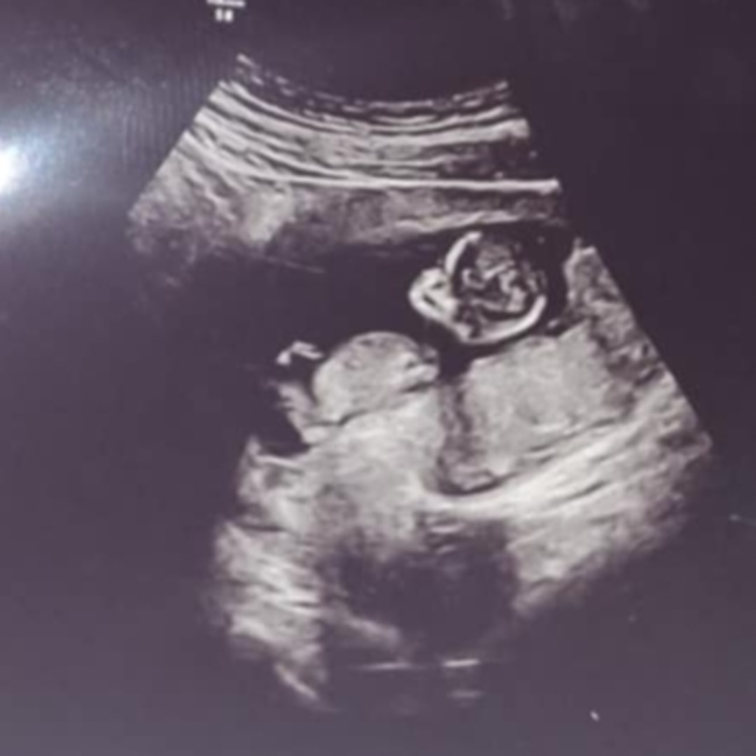 Photo shared by Amethyst for their Babylist baby registry.