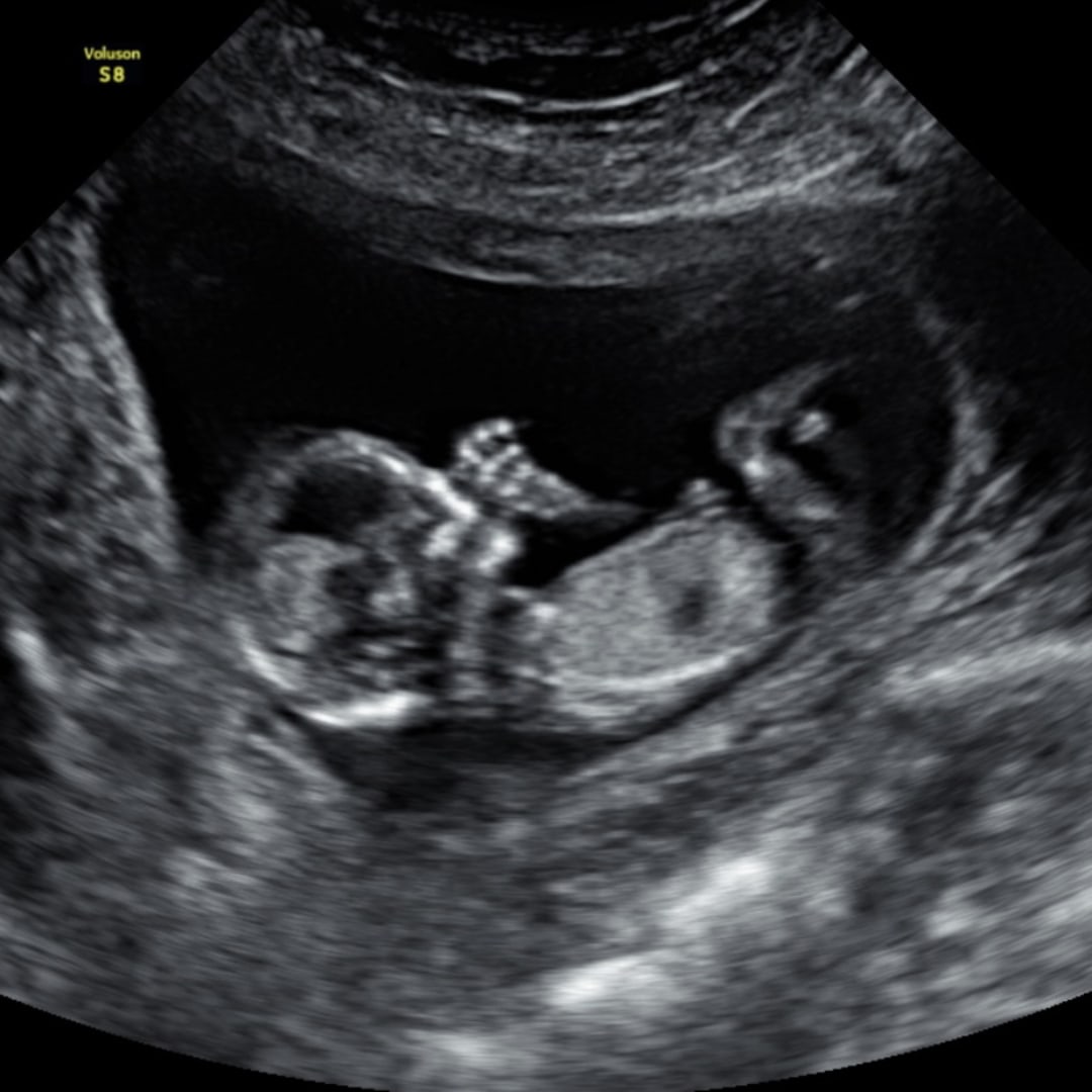 Photo shared by Haley for their Babylist baby registry.