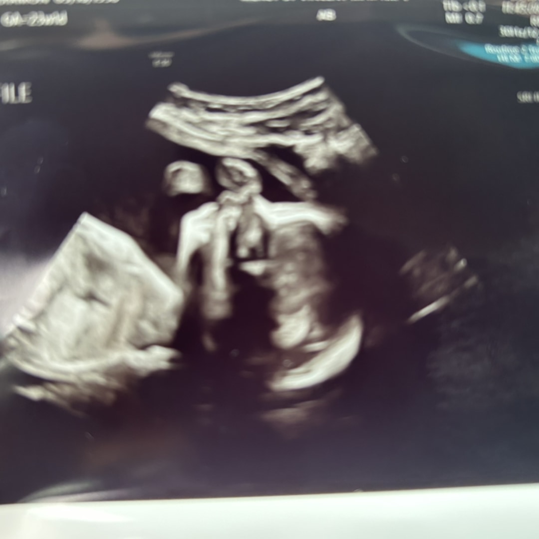 Photo shared by Diamon for their Babylist baby registry.